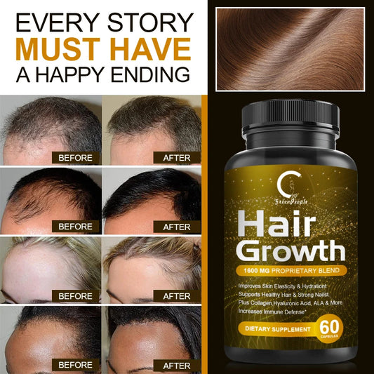 MINCH 5000mcg Biotin Capsules For Hair Skin And Immunity Support