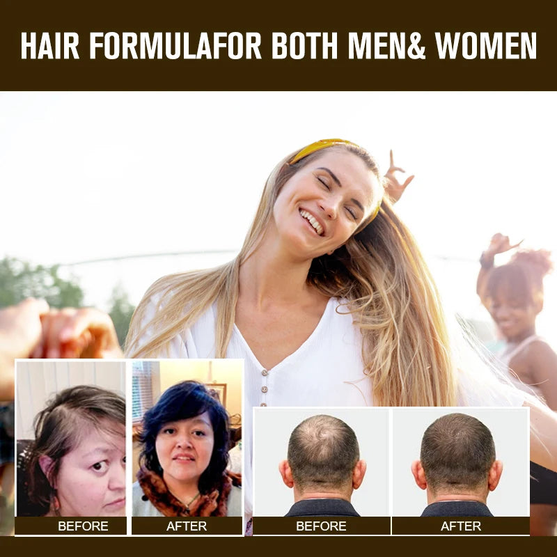 MINCH 5000mcg Biotin Capsules For Hair Skin And Immunity Support
